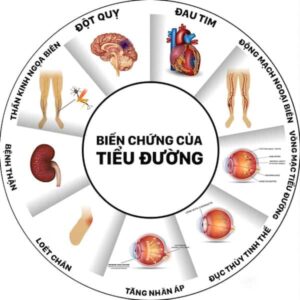 Maxi Blood Sugar Balance - Hỗ Trợ Người Bệnh Tiểu Đường